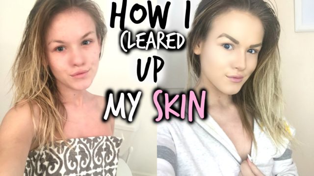 My Winter Skincare Routine | How I Cleared My Skin