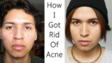 My Skincare Routine (For Acne)  * How I Got Rid Of Acne